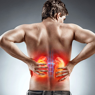 Park Slope Urology | Urolift, Sexually Transmitted Disease and Vasectomy